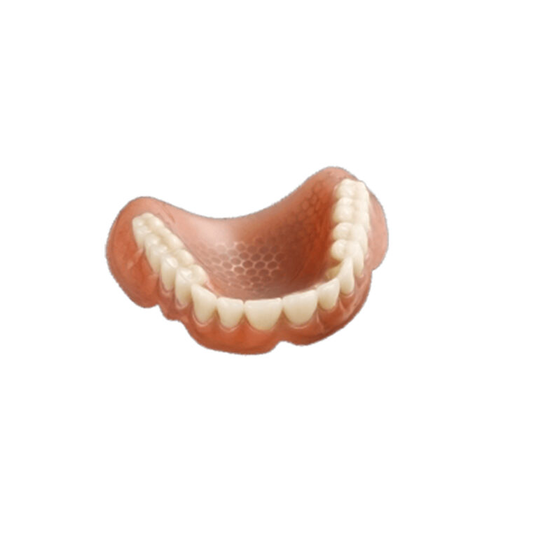 Wire Mesh Denture
