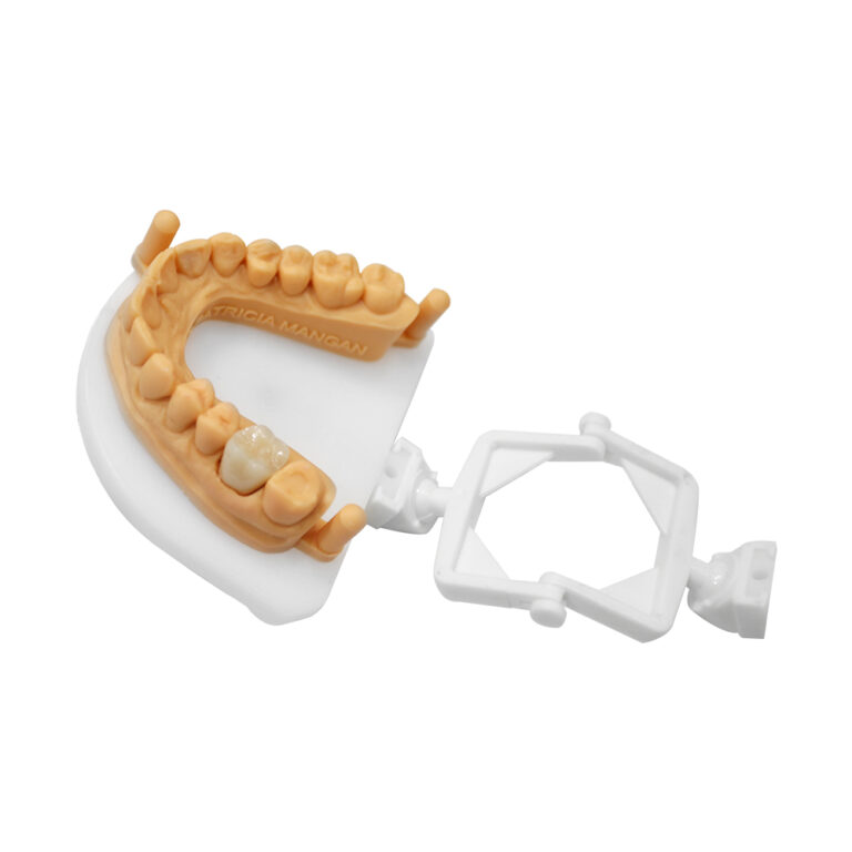 Zirconia Crown Molar