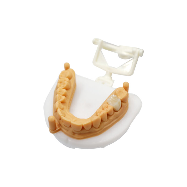 Zirconia Crown for Posterior Teeth