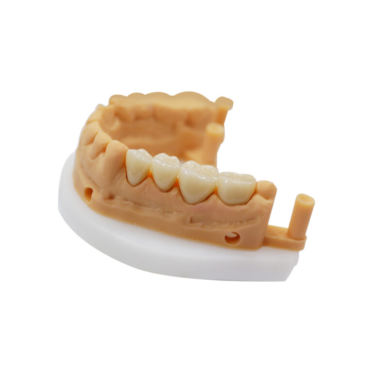 Zirconia Crown for Posterior Teeth