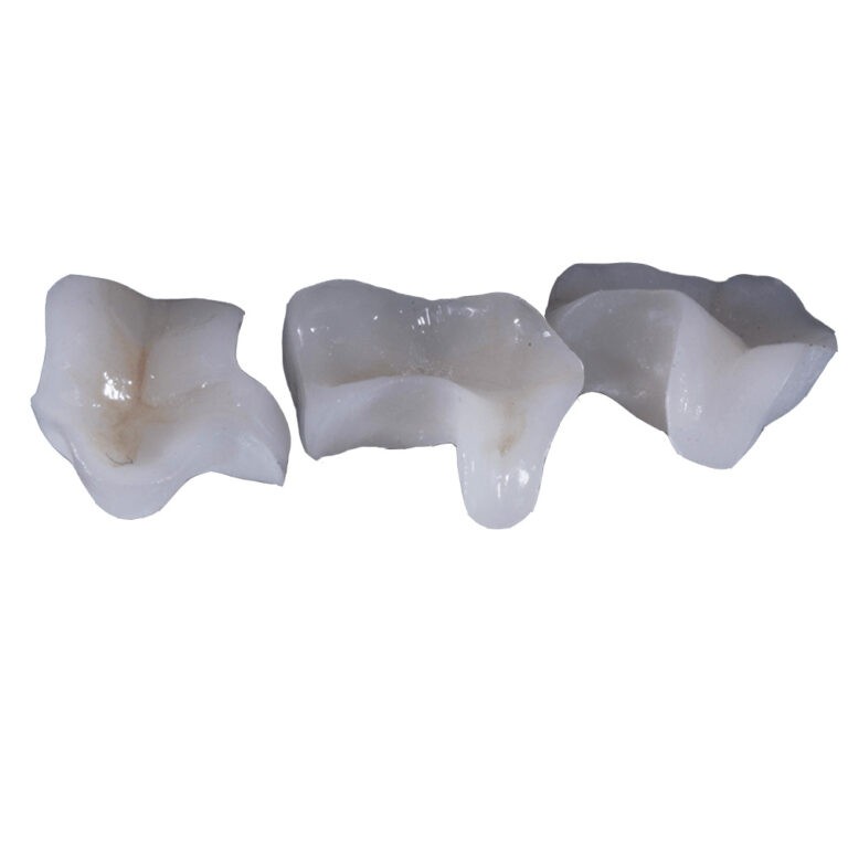 Zirconia Inlay