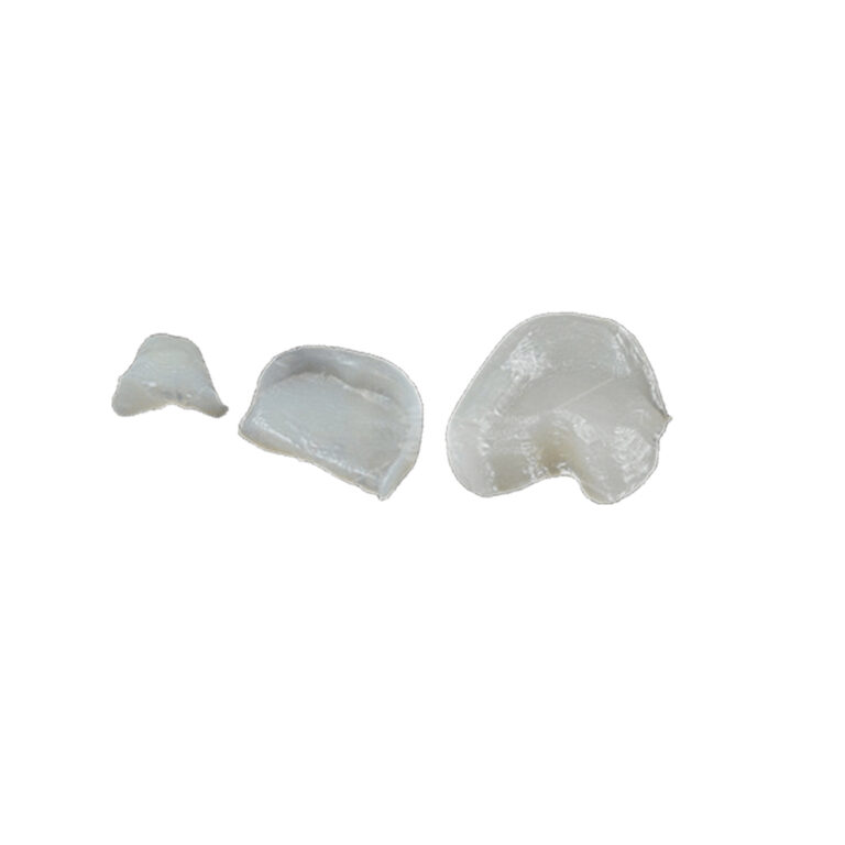 Zirconia Inlay