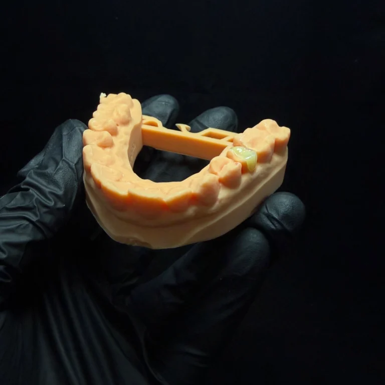 Zirconia Inlay case
