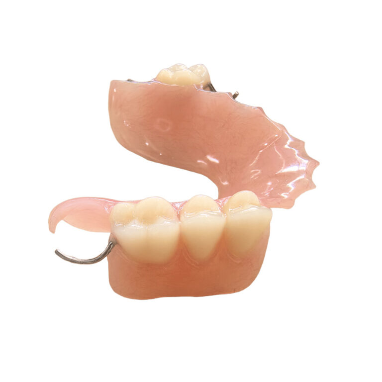 acrylic partial denture