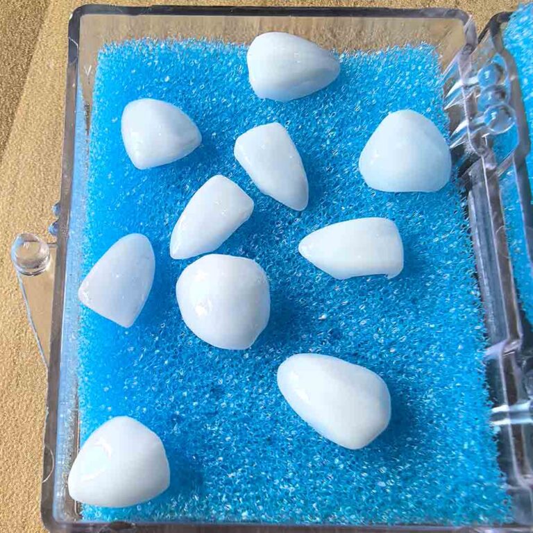 cementing emax veneers