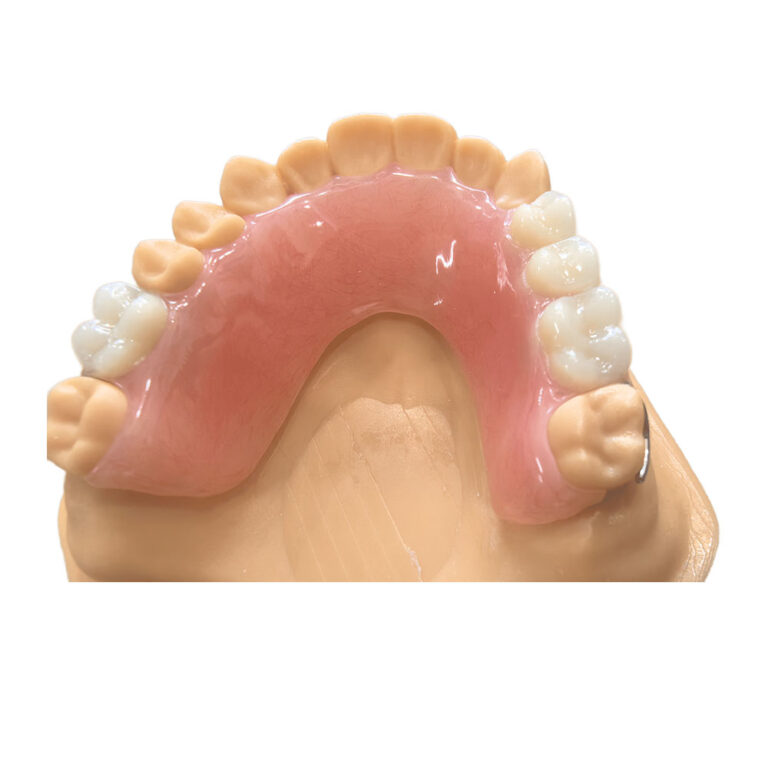 partial dentures