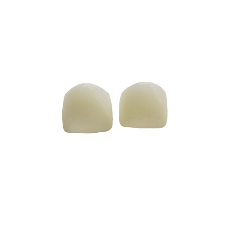 corone pediatriche in zirconia