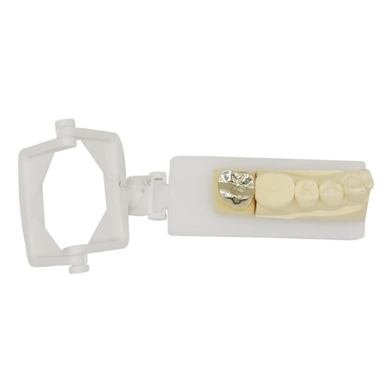 porcelain fused to high noble metal