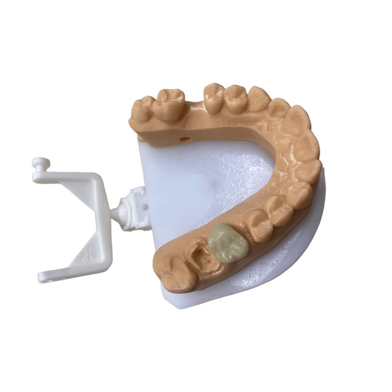 denti inferiori provvisori