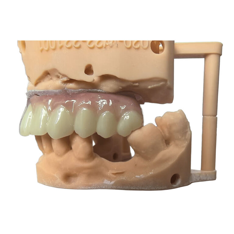 zircone all on 4 (1)