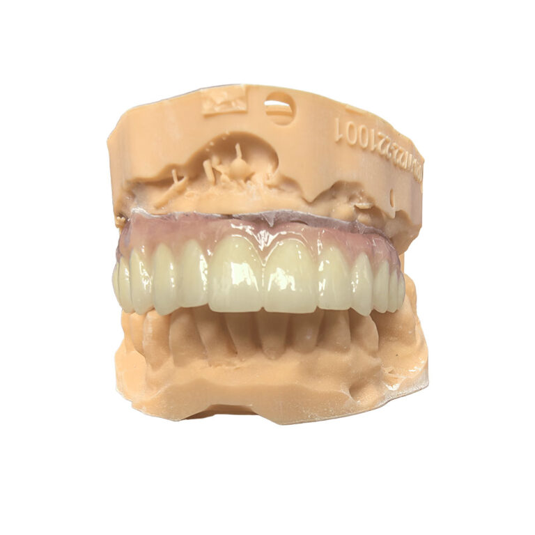 implants dentaires zircone all on 4