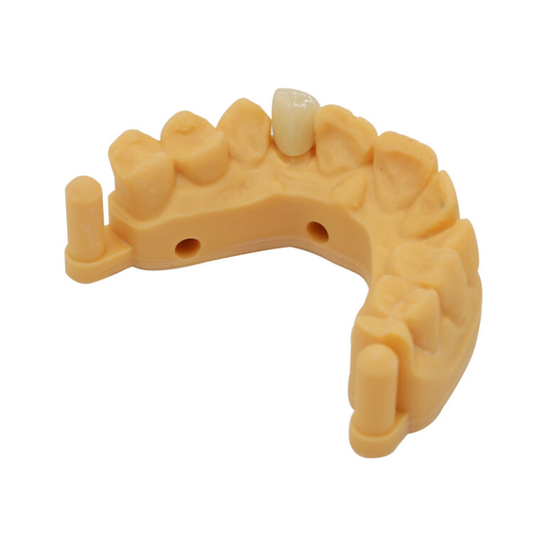 zirconia veneer