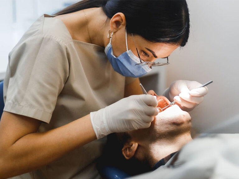 Tartre sur les dents