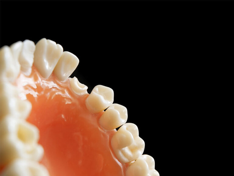 impianti dentali