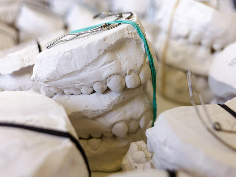 gips dentystyczny