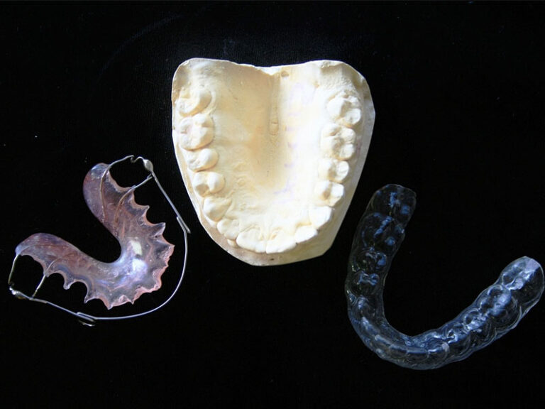 apparecchio ortodontico