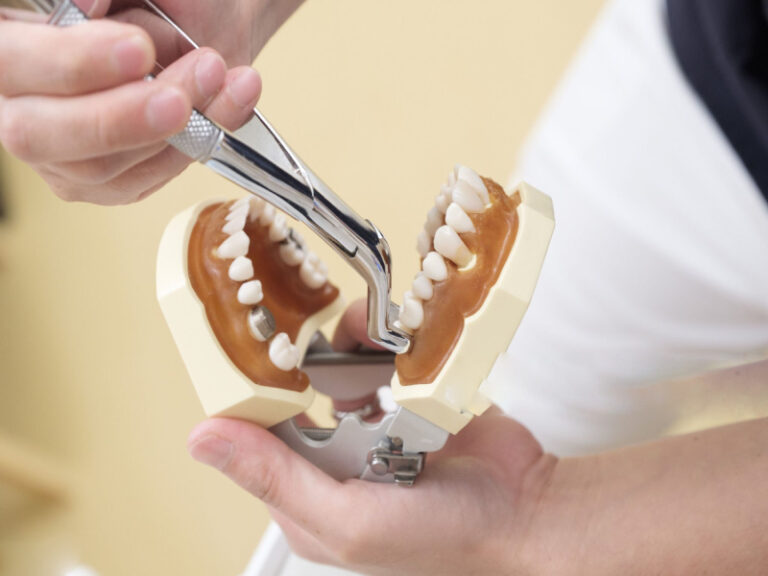 Opciones de sustitución de dientes tras una extracción (1)