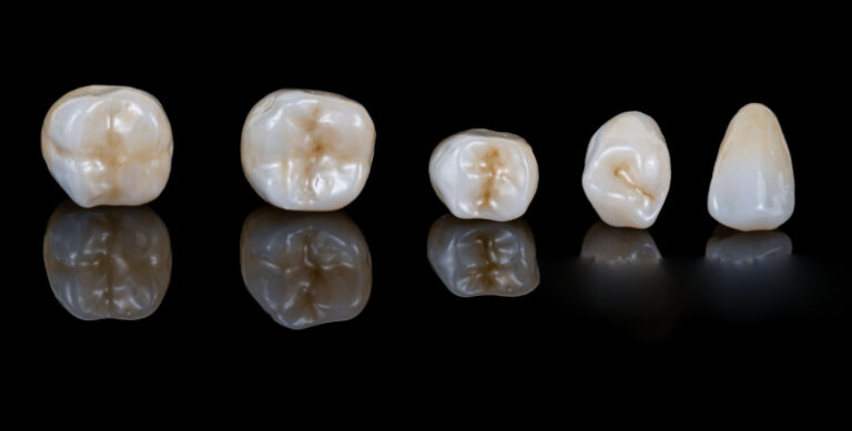 confronto tra generazioni di zirconia, proprietà della zirconia stabilizzata con ittrio (1)