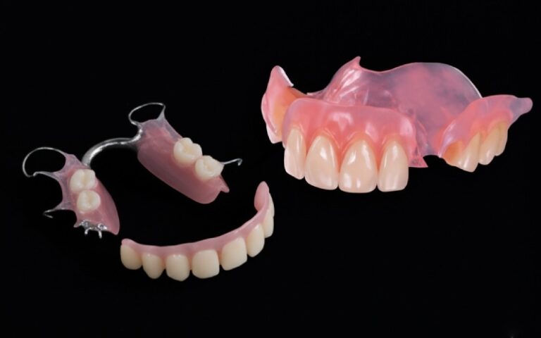 Comparaison des matériaux flexibles pour prothèses dentaires