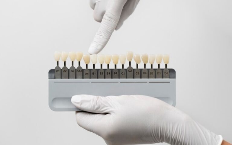 Guía de colores Dental VITA con materiales compuestos