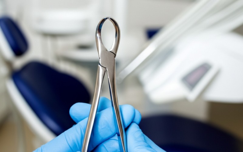 Dental professional holding extraction forceps