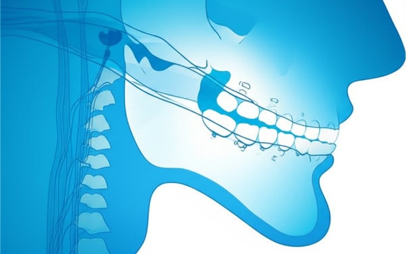 voies aériennes ouvertes avec appareil buccal