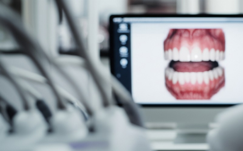 Escáner dental digital y modelo dental en 3D