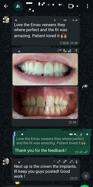 ASD Dental Lab Customer Reviews (1)