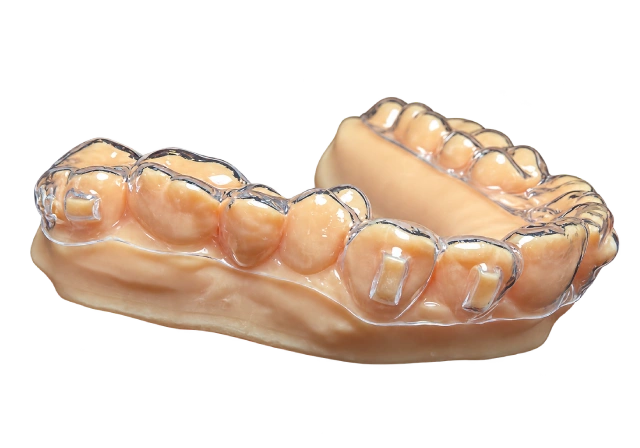 Essix _ Vacuum-Formed Clear Retainer