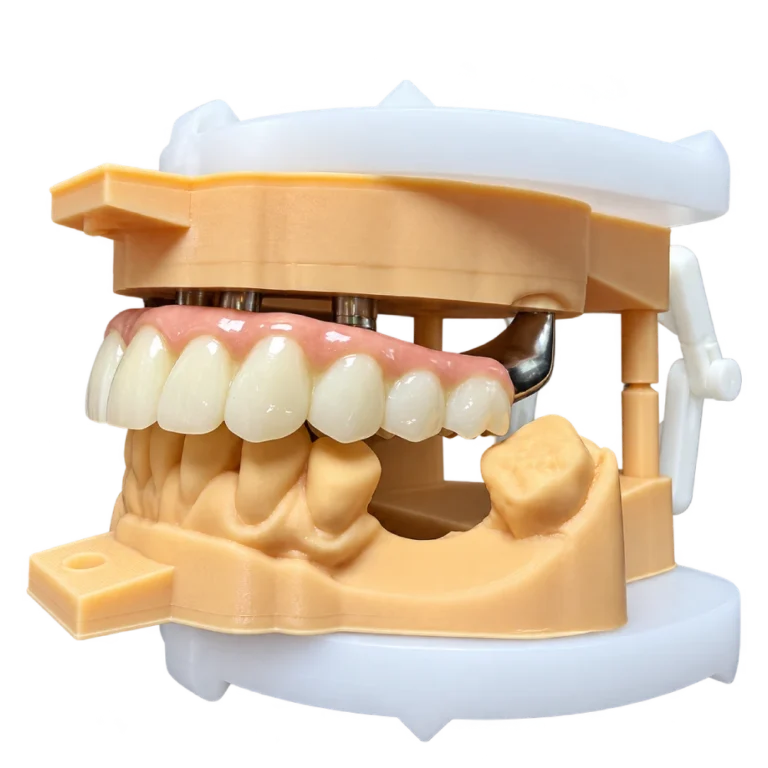 Implant Full Zirconia Crown (1)