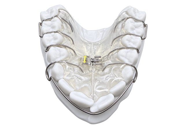 Retainers (Hawley, Essix, bonded lingual)
