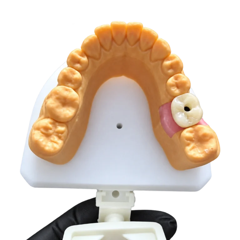 Zirconia Implant Crown (1)