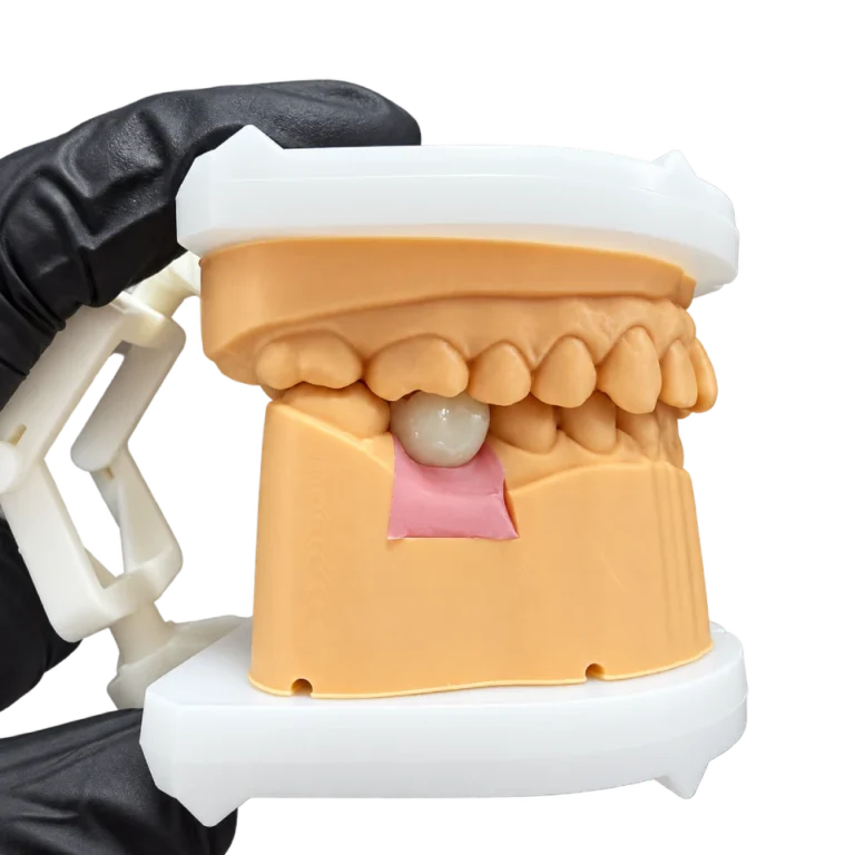Zirconia Implant Crown (2)