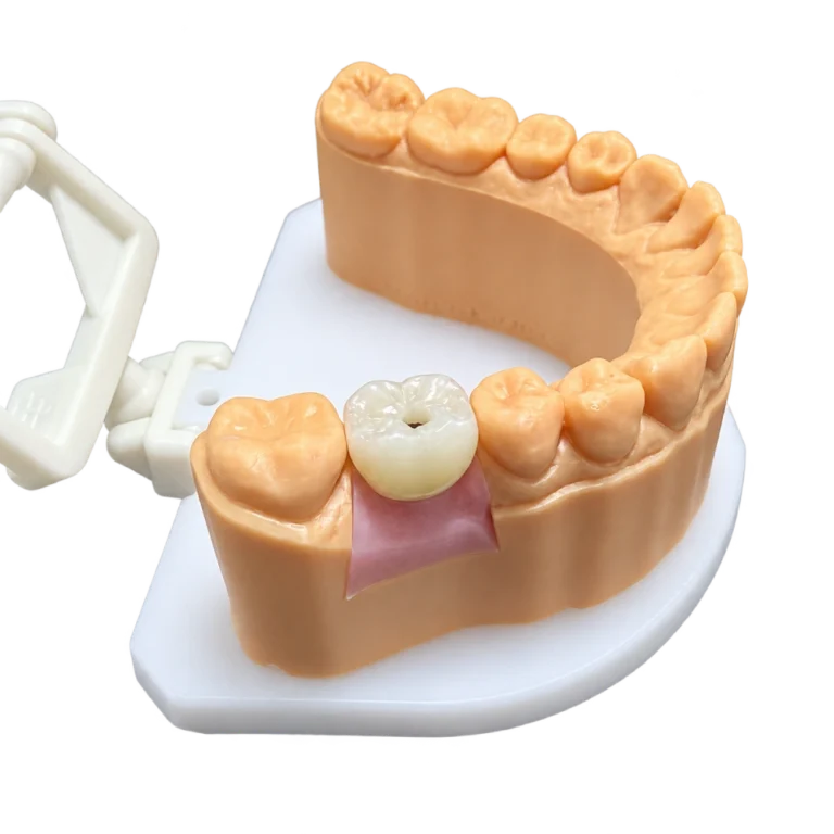 Zirconia Implant Crown