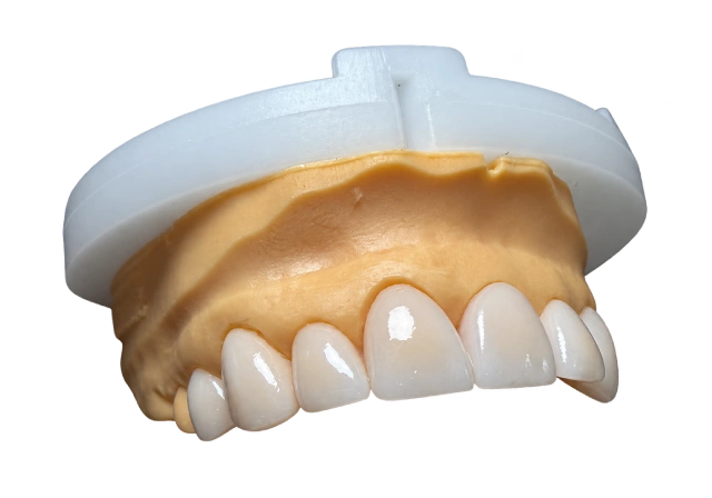 dental lab Veneers