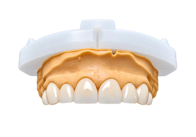 porcelain veneers