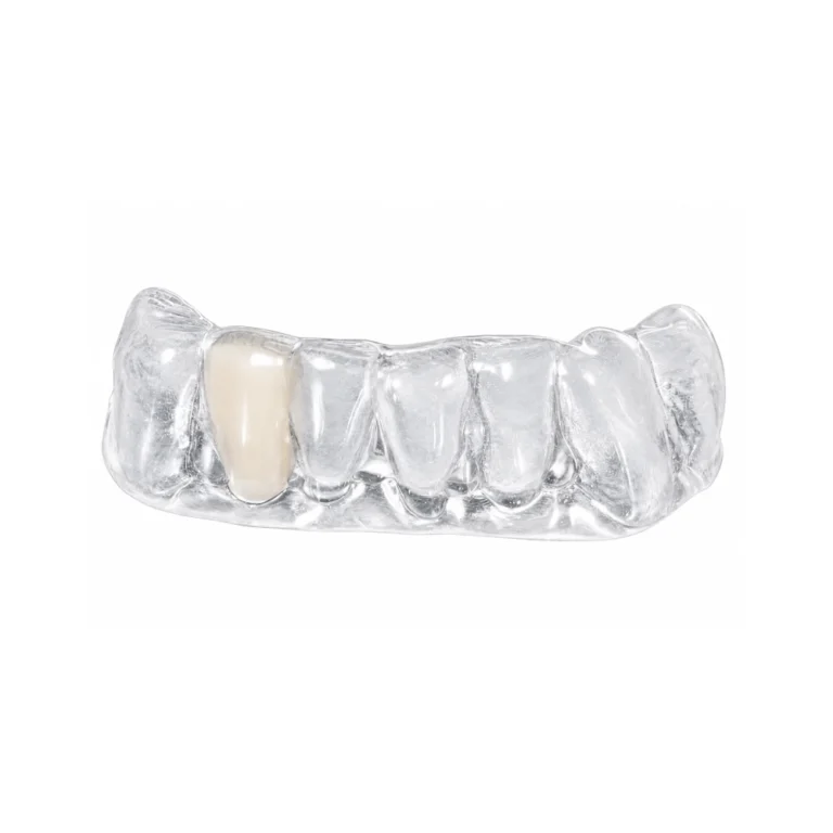 temporary tooth after extraction