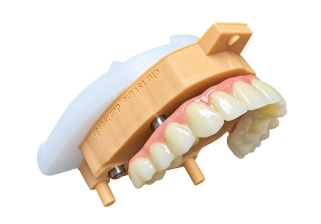 upper dental implants